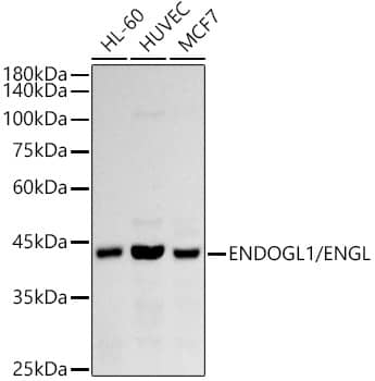 Western Blot: ENDOGL1 Antibody (2W6V1) [NBP3-33188] - Western blot analysis of various lysates using ENDOGL1 Rabbit mAb at 1:1000 dilution.Secondary antibody: HRP-conjugated Goat anti-Rabbit IgG (H+L) at 1:10000 dilution.Lysates/proteins: 25ug per lane.Blocking buffer: 3% nonfat dry milk in TBST.Detection: ECL Basic Kit.Exposure time: 90s.