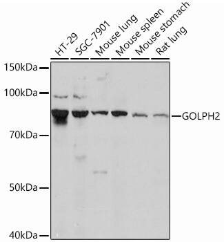 Western Blot: GOLM1 Antibody (2Q4F0) [NBP3-33189] - Western blot analysis of various lysates using GOLM1 Rabbit mAb at 1: 1000 dilution.Secondary antibody: HRP-conjugated Goat anti-Rabbit IgG (H+L) at 1:10000 dilution.Lysates/proteins: 25ug per lane.Blocking buffer: 3% nonfat dry milk in TBST.Detection: ECL Basic Kit.Exposure time: 3min.