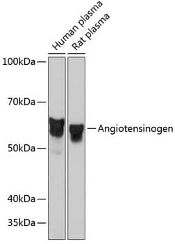 Western Blot: Serpin A8/Angiotensinogen Antibody (9Q5D4) [NBP3-33190] - Western blot analysis of various lysates using Serpin A8/Angiotensinogen Rabbit mAb at 1:1000 dilution.Secondary antibody: HRP-conjugated Goat anti-Rabbit IgG (H+L) at 1:10000 dilution.Lysates/proteins: 25ug per lane.Blocking buffer: 3% nonfat dry milk in TBST.Detection: ECL Basic Kit.Exposure time: 3s.