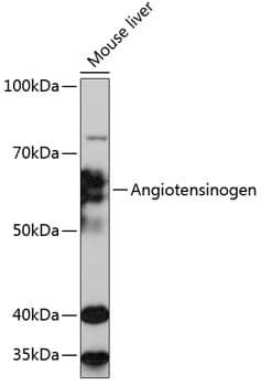 Western Blot: Serpin A8/Angiotensinogen Antibody (9Q5D4) [NBP3-33190] - Western blot analysis of lysates from Mouse liver, using Serpin A8/Angiotensinogen Rabbit mAb at 1:1000 dilution.Secondary antibody: HRP-conjugated Goat anti-Rabbit IgG (H+L) at 1:10000 dilution.Lysates/proteins: 25ug per lane.Blocking buffer: 3% nonfat dry milk in TBST.Detection: ECL Basic Kit.Exposure time: 30s.