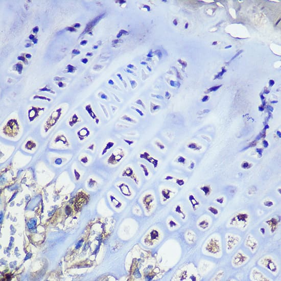 Immunohistochemistry: Aggrecan Antibody (6L4T2) [NBP3-33191] - Immunohistochemistry analysis of paraffin-embedded Mouse bone marrow using Aggrecan Rabbit mAb at dilution of 1:100 (40x lens). Microwave antigen retrieval performed with 0.01M PBS Buffer (pH 7.2) prior to IHC staining.