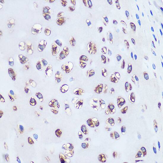 Immunohistochemistry: Aggrecan Antibody (6L4T2) [NBP3-33191] - Immunohistochemistry analysis of paraffin-embedded Rat bone marrow using Aggrecan Rabbit mAb at dilution of 1:100 (40x lens). Microwave antigen retrieval performed with 0.01M PBS Buffer (pH 7.2) prior to IHC staining.