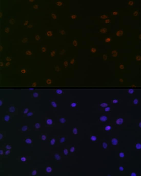 Immunocytochemistry/ Immunofluorescence: SUPT5H Antibody (9V9G7) [NBP3-33195] - Immunofluorescence analysis of C6 cells using SUPT5H Rabbit mAb at dilution of 1:100 (40x lens). Secondary antibody: Cy3-conjugated Goat anti-Rabbit IgG (H+L) at 1:500 dilution. Blue: DAPI for nuclear staining.