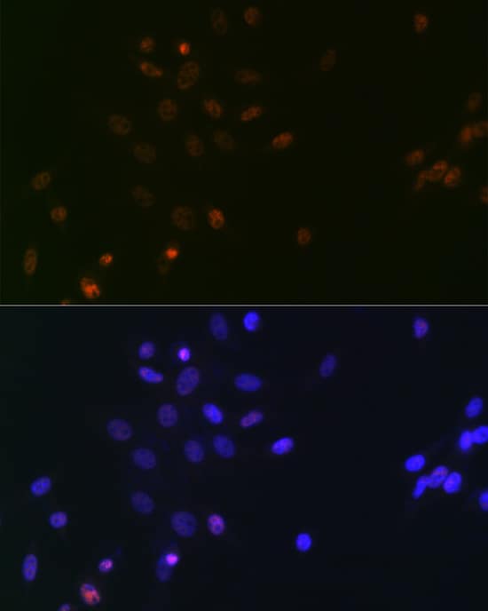 Immunocytochemistry/ Immunofluorescence: SUPT5H Antibody (9V9G7) [NBP3-33195] - Immunofluorescence analysis of NIH/3T3 cells using SUPT5H Rabbit mAb at dilution of 1:100 (40x lens). Secondary antibody: Cy3-conjugated Goat anti-Rabbit IgG (H+L) at 1:500 dilution. Blue: DAPI for nuclear staining.