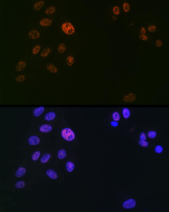 Immunocytochemistry/ Immunofluorescence: SUPT5H Antibody (9V9G7) [NBP3-33195] - Immunofluorescence analysis of U2OS cells using SUPT5H Rabbit mAb at dilution of 1:100 (40x lens). Secondary antibody: Cy3-conjugated Goat anti-Rabbit IgG (H+L) at 1:500 dilution. Blue: DAPI for nuclear staining.