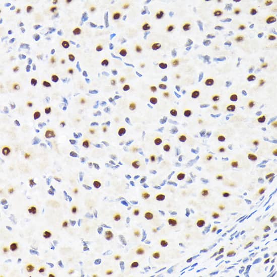 Immunohistochemistry: SUPT5H Antibody (9V9G7) [NBP3-33195] - Immunohistochemistry analysis of paraffin-embedded Rat ovary using SUPT5H Rabbit mAb at dilution of 1:100 (40x lens). Microwave antigen retrieval performed with 0.01M Tris/EDTA Buffer (pH 9.0) prior to IHC staining.