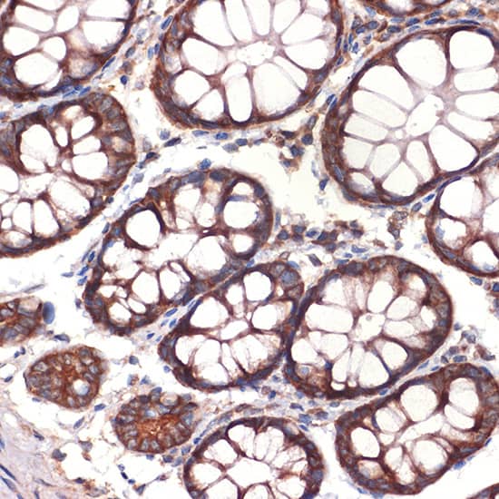 Immunohistochemistry: CC2D1A Antibody (5Y6S6) [NBP3-33196] - Immunohistochemistry analysis of paraffin-embedded Human colon using CC2D1A Rabbit mAb at dilution of 1:100 (40x lens). Microwave antigen retrieval performed with 0.01M Tris/EDTA Buffer (pH 9.0) prior to IHC staining.