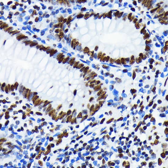 Immunohistochemistry: Histone H4 [ac Lys5] Antibody (10G1L0) [NBP3-33198] - Immunohistochemistry analysis of paraffin-embedded Human appendix using Histone H4 Rabbit mAb at dilution of 1:100 (40x lens). Microwave antigen retrieval performed with 0.01M PBS Buffer (pH 7.2) prior to IHC staining.