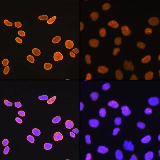 Immunocytochemistry/ Immunofluorescence: Histone H4 [ac Lys5] Antibody (10G1L0) [NBP3-33198] - Immunofluorescence analysis of U-2 OS cells using Histone H4 Rabbit mAb.U-2 OS cells were treated by TSA (1 uM) at 37C for 18 hours(left). Secondary antibody: Cy3-conjugated Goat anti-Rabbit IgG (H+L) at 1:500 dilution. Blue: DAPI for nuclear staining.