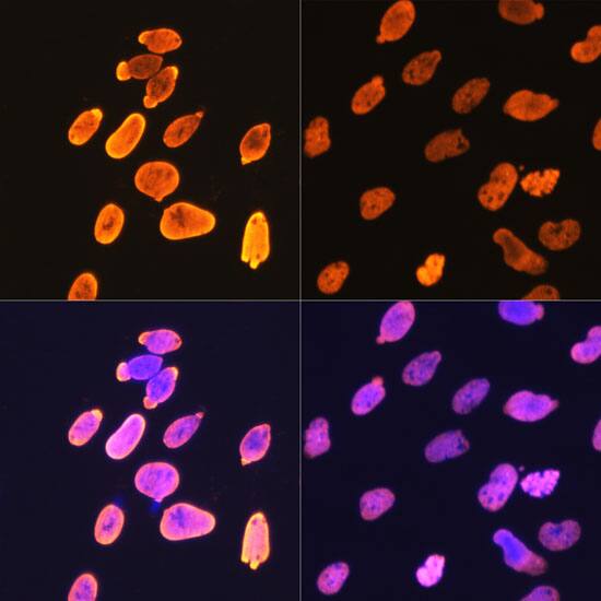 Immunocytochemistry/ Immunofluorescence: Histone H4 [ac Lys5] Antibody (10G1L0) [NBP3-33198] - Immunofluorescence analysis of C6 cells using Histone H4 Rabbit mAb.C6 cells were treated by TSA (1 uM) at 37C for 18 hours(left). Secondary antibody: Cy3-conjugated Goat anti-Rabbit IgG (H+L) at 1:500 dilution. Blue: DAPI for nuclear staining.