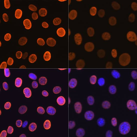 Immunocytochemistry/ Immunofluorescence: Histone H4 [ac Lys5] Antibody (10G1L0) [NBP3-33198] - Immunofluorescence analysis of NIH-3T3 cells using Histone H4 Rabbit mAb.NIH-3T3 cells were treated by TSA (1 uM) at 37C for 18 hours(left). Secondary antibody: Cy3-conjugated Goat anti-Rabbit IgG (H+L) at 1:500 dilution. Blue: DAPI for nuclear staining.