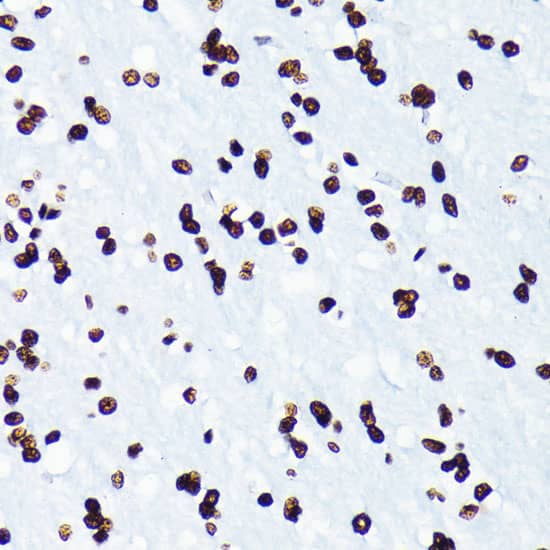 Immunohistochemistry: Histone H4 [ac Lys5] Antibody (10G1L0) [NBP3-33198] - Immunohistochemistry analysis of paraffin-embedded Rat brain using Histone H4 Rabbit mAb at dilution of 1:100 (40x lens). Microwave antigen retrieval performed with 0.01M PBS Buffer (pH 7.2) prior to IHC staining.