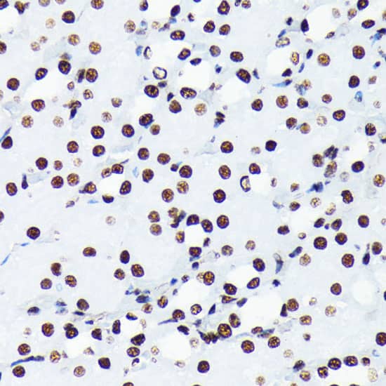 Immunohistochemistry: Histone H4 [ac Lys5] Antibody (10G1L0) [NBP3-33198] - Immunohistochemistry analysis of paraffin-embedded Mouse kidney using Histone H4 Rabbit mAb at dilution of 1:100 (40x lens). Microwave antigen retrieval performed with 0.01M PBS Buffer (pH 7.2) prior to IHC staining.