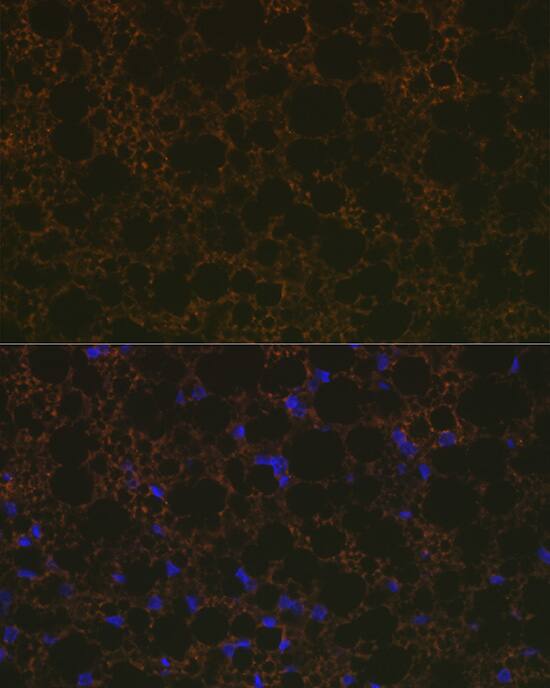 Immunocytochemistry/ Immunofluorescence UCP1/3 Antibody (0S10O10)