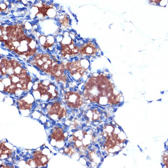 Immunohistochemistry UCP1/3 Antibody (0S10O10)