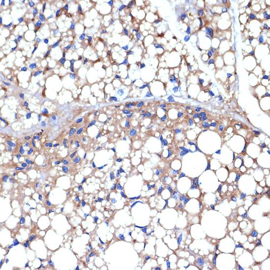 Immunohistochemistry UCP1/3 Antibody (0S10O10)
