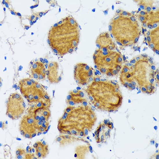 Immunohistochemistry: Thyroid Peroxidase Antibody (3C4A4) [NBP3-33200] - Immunohistochemistry analysis of paraffin-embedded Mouse thyroid using Thyroid Peroxidase Rabbit mAb at dilution of 1:100 (40x lens). Microwave antigen retrieval performed with 0.01M Tris/EDTA Buffer (pH 9.0) prior to IHC staining.