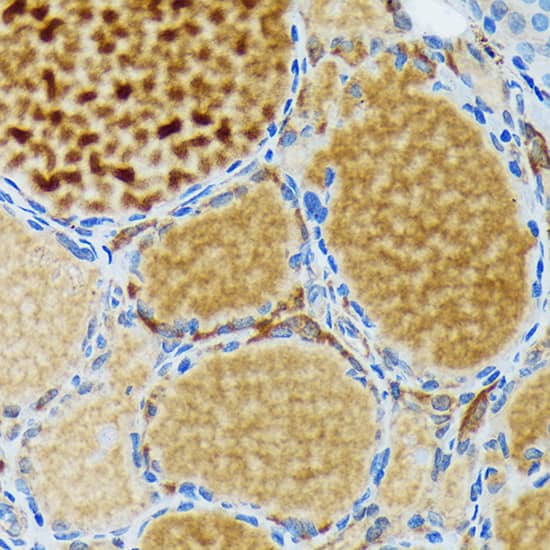 Immunohistochemistry: Thyroid Peroxidase Antibody (3C4A4) [NBP3-33200] - Immunohistochemistry analysis of paraffin-embedded Rat thyroid using Thyroid Peroxidase Rabbit mAb at dilution of 1:100 (40x lens). Microwave antigen retrieval performed with 0.01M Tris/EDTA Buffer (pH 9.0) prior to IHC staining.