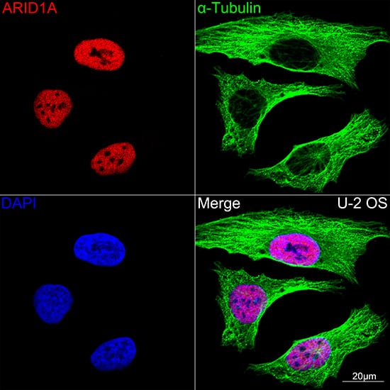 Immunocytochemistry/ Immunofluorescence: ARID1A Antibody (9D4J6) [NBP3-33201] - Confocal imaging of U-2 OS cells using ARID1A Rabbit mAb(Red). The cells were counterstained with  alpha -Tubulin Mouse mAb (Green). DAPI was used for nuclear staining (blue). Objective: 100x.