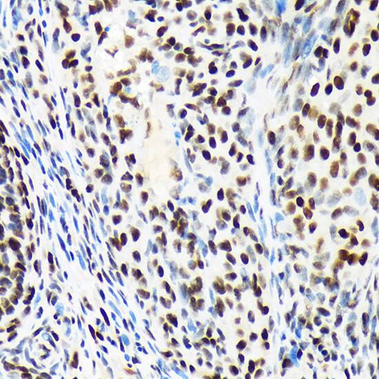 Immunohistochemistry: ARID1A Antibody (9D4J6) [NBP3-33201] - Immunohistochemistry analysis of paraffin-embedded Rat ovary using ARID1A Rabbit mAb at dilution of 1:100 (40x lens). Microwave antigen retrieval performed with 0.01M Tris/EDTA Buffer (pH 9.0) prior to IHC staining.