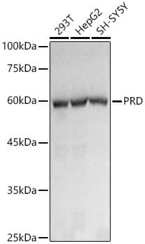 Western Blot: PEPD Antibody (5C7U8) [NBP3-33202] - Western blot analysis of various lysates using PEPD Rabbit mAb at1:1000 dilution.Secondary antibody: HRP-conjugated Goat anti-Rabbit IgG (H+L) at 1:10000 dilution.Lysates/proteins: 25ug per lane.Blocking buffer: 3% nonfat dry milk in TBST.Detection: ECL Basic Kit.Exposure time: 1s.