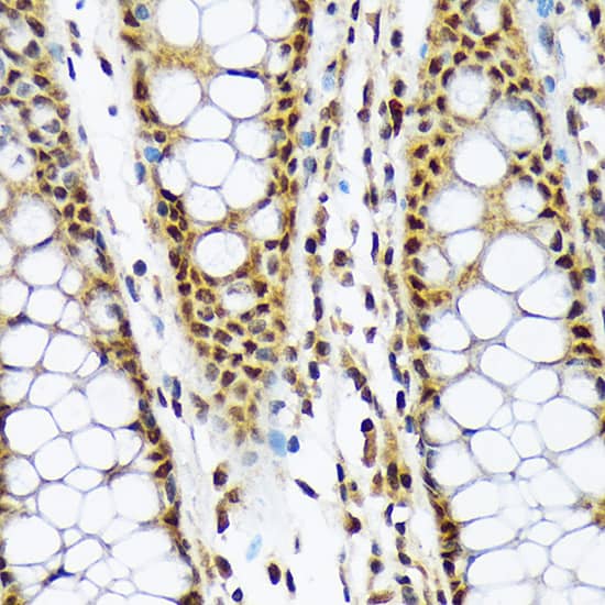 Immunohistochemistry MAD2L1-binding protein Antibody (7W8H1)