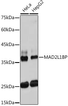 Western Blot: MAD2L1-binding protein Antibody (7W8H1) [NBP3-33204] - Western blot analysis of various lysates using MAD2L1-binding protein Rabbit mAb at 1:1000 dilution.Secondary antibody: HRP-conjugated Goat anti-Rabbit IgG (H+L) at 1:10000 dilution.Lysates/proteins: 25ug per lane.Blocking buffer: 3% nonfat dry milk in TBST.Detection: ECL Basic Kit.Exposure time: 30s.