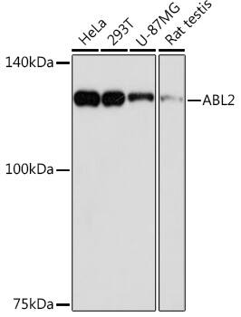 Western Blot: ABL2 Antibody (2L9C6) [NBP3-33205] - Western blot analysis of various lysates using ABL2 Rabbit mAb at 1:1000 dilution.Secondary antibody: HRP-conjugated Goat anti-Rabbit IgG (H+L) at 1:10000 dilution.Lysates/proteins: 25ug per lane.Blocking buffer: 3% nonfat dry milk in TBST.Detection: ECL Basic Kit.Exposure time: 90s.