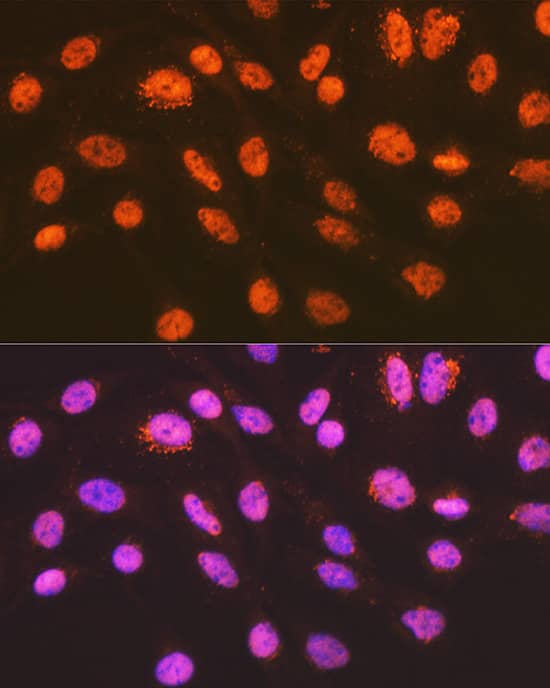 Immunocytochemistry/ Immunofluorescence: ENT2 Antibody (7B2J3) [NBP3-33206] - Confocal imaging of C2C12 cells using ENT2/SLC29A2 Rabbit mAb followed by a further incubation with Cy3 Goat Anti-Rabbit IgG (H+L). The cells were counterstained with  alpha -Tubulin Mouse mAb followed by incubation with ABflo® 488-conjugated Goat Anti-Mouse IgG (H+L) Ab (Green). DAPI was used for nuclear staining (Blue). Objective: 100x.