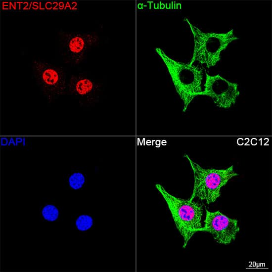 Immunocytochemistry/ Immunofluorescence ENT2 Antibody (7B2J3)