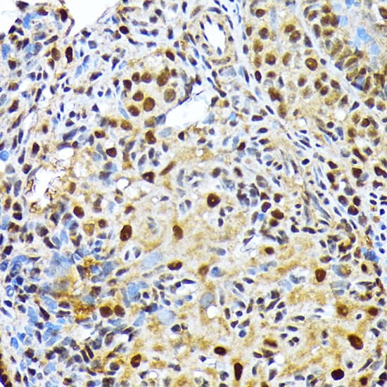 Immunohistochemistry: ENT2 Antibody (7B2J3) [NBP3-33206] - Immunohistochemistry analysis of paraffin-embedded Rat ovary using ENT2 Rabbit mAb at dilution of 1:100 (40x lens). Microwave antigen retrieval performed with 0.01M Tris/EDTA Buffer (pH 9.0) prior to IHC staining.