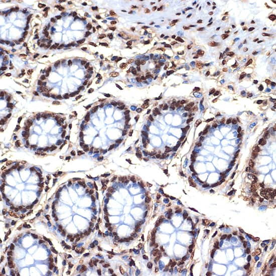 Immunohistochemistry: Histone H4 Antibody (4R4N3) [NBP3-33209] - Immunohistochemistry analysis of paraffin-embedded Human colon using Histone H4 Rabbit mAb at dilution of 1:100 (40x lens). Microwave antigen retrieval performed with 0.01M Tris/EDTA Buffer (pH 9.0) prior to IHC staining.