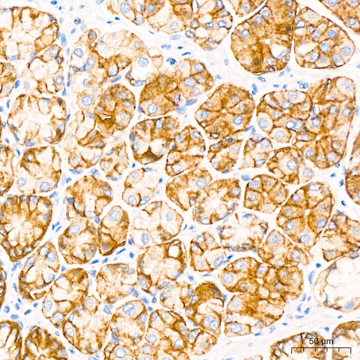 Immunohistochemistry: Claudin-18.2 Antibody (3J4G7) [NBP3-33211] - Immunohistochemistry analysis of paraffin-embedded Human stomach using Claudin-18.2 Rabbit mAb at dilution of 1:50 (40x lens). High pressure antigen retrieval performed with 0.01M Tris/EDTA Buffer (pH 9.0) prior to IHC staining.