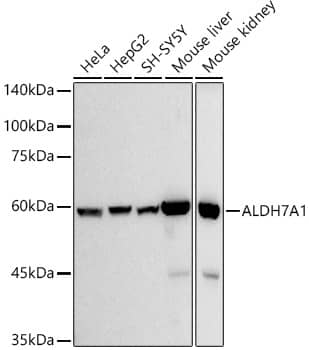 Western Blot: ALDH7A1 Antibody (3I6B6) [NBP3-33216] - Western blot analysis of various lysates using ALDH7A1 Rabbit mAb at 1:500 dilution.Secondary antibody: HRP-conjugated Goat anti-Rabbit IgG (H+L) at 1:10000 dilution.Lysates/proteins: 25ug per lane.Blocking buffer: 3% nonfat dry milk in TBST.Detection: ECL Basic Kit.Exposure time: 10s.