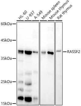 Western Blot: RASSF2 Antibody (5U1E0) [NBP3-33223] - Western blot analysis of various lysates, using RASSF2 Rabbit mAb at 1:500 dilution.Secondary antibody: HRP-conjugated Goat anti-Rabbit IgG (H+L) at 1:10000 dilution.Lysates/proteins: 25ug per lane.Blocking buffer: 3% nonfat dry milk in TBST.Detection: ECL Basic Kit.Exposure time: 180s.
