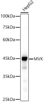 Western Blot: MVK Antibody (9K1A1) [NBP3-33225] - Western blot analysis of lysates from HepG2 cells, using MVK Rabbit mAb at 1:500 dilution.Secondary antibody: HRP-conjugated Goat anti-Rabbit IgG (H+L) at 1:10000 dilution.Lysates/proteins: 25ug per lane.Blocking buffer: 3% nonfat dry milk in TBST.Detection: ECL Basic Kit.Exposure time: 30s.