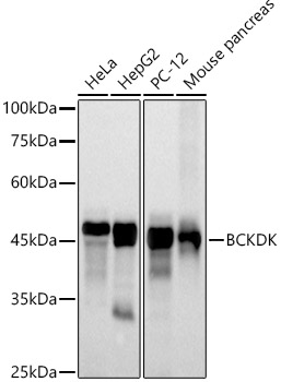 Western Blot: BCKDK Antibody (5J3L3) [NBP3-33228] - Western blot analysis of various lysates using BCKDK Rabbit mAb at 1:500 dilution.Secondary antibody: HRP-conjugated Goat anti-Rabbit IgG (H+L) at 1:10000 dilution.Lysates/proteins: 25ug per lane.Blocking buffer: 3% nonfat dry milk in TBST.Detection: ECL Basic Kit.Exposure time: 30s.