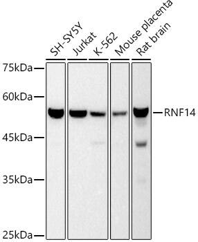 Western Blot: ARA54 Antibody (4X10Q6) [NBP3-33230] - Western blot analysis of various lysates using ARA54 Rabbit mAb at 1:500 dilution.Secondary antibody: HRP-conjugated Goat anti-Rabbit IgG (H+L) at 1:10000 dilution.Lysates/proteins: 25ug per lane.Blocking buffer: 3% nonfat dry milk in TBST.Detection: ECL Basic Kit.Exposure time: 10s.