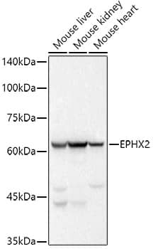 Western Blot: EPHX2 Antibody (8E2X2) [NBP3-33234] - Western blot analysis of various lysates using EPHX2 Rabbit mAb at 1:500 dilution.Secondary antibody: HRP-conjugated Goat anti-Rabbit IgG (H+L) at 1:10000 dilution.Lysates/proteins: 25ug per lane.Blocking buffer: 3% nonfat dry milk in TBST.Detection: ECL Basic Kit.Exposure time: 1s.