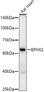 Western Blot: EPHX2 Antibody (8E2X2) [NBP3-33234] - Western blot analysis of lysates from Rat heart, using EPHX2 Rabbit mAb at 1:500 dilution.Secondary antibody: HRP-conjugated Goat anti-Rabbit IgG (H+L) at 1:10000 dilution.Lysates/proteins: 25ug per lane.Blocking buffer: 3% nonfat dry milk in TBST.Detection: ECL Basic Kit.Exposure time: 60s.