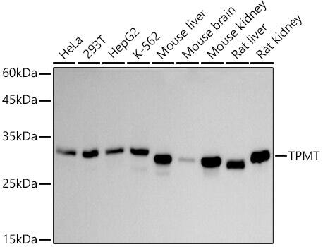 Western Blot: TPMT Antibody (4P2U9) [NBP3-33235] - Western blot analysis of various lysates using TPMT Rabbit mAb at 1:1000 dilution.Secondary antibody: HRP-conjugated Goat anti-Rabbit IgG (H+L) at 1:10000 dilution.Lysates/proteins: 25ug per lane.Blocking buffer: 3% nonfat dry milk in TBST.Detection: ECL Basic Kit.Exposure time: 30s.