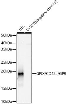 Western Blot: GP-IX Antibody (9C6U5) [NBP3-33238] - Western blot analysis of various lysates, using GP-IX Rabbit mAb at 1:1000 dilution.Secondary antibody: HRP-conjugated Goat anti-Rabbit IgG (H+L) at 1:10000 dilution.Lysates/proteins: 25ug per lane.Blocking buffer: 3% nonfat dry milk in TBST.Detection: ECL Basic Kit.Exposure time: 30s.