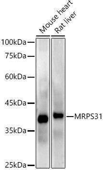 Western Blot: MRPS31 Antibody (3J3T5) [NBP3-33240] - Western blot analysis of various lysates using MRPS31 Rabbit mAb at 1:1000 dilution.Secondary antibody: HRP-conjugated Goat anti-Rabbit IgG (H+L) at 1:10000 dilution.Lysates/proteins: 25ug per lane.Blocking buffer: 3% nonfat dry milk in TBST.Detection: ECL Enhanced Kit.Exposure time: 180s.