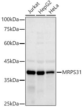 Western Blot: MRPS31 Antibody (3J3T5) [NBP3-33240] - Western blot analysis of various lysates using MRPS31 Rabbit mAb at 1:1000 dilution.Secondary antibody: HRP-conjugated Goat anti-Rabbit IgG (H+L) at 1:10000 dilution.Lysates/proteins: 25ug per lane.Blocking buffer: 3% nonfat dry milk in TBST.Detection: ECL Basic Kit.Exposure time: 180s.