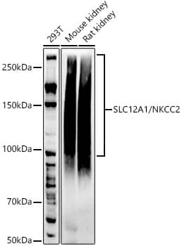 Western Blot: NKCC2/SLC12A1 Antibody (9I0U8) [NBP3-33241] - Western blot analysis of various lysates using NKCC2/SLC12A1 Rabbit mAb at 1:1000 dilution.Secondary antibody: HRP-conjugated Goat anti-Rabbit IgG (H+L) at 1:10000 dilution.Lysates/proteins: 25ug per lane.Blocking buffer: 3% nonfat dry milk in TBST.Detection: ECL Basic Kit.Exposure time: 60s.