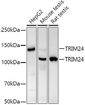 Western Blot: TIF1 alpha Antibody (9I0X1) [NBP3-33244] - Western blot analysis of various lysates using TIF1 alpha Rabbit mAb at 1:1000 dilution.Secondary antibody: HRP-conjugated Goat anti-Rabbit IgG (H+L) at 1:10000 dilution.Lysates/proteins: 25ug per lane.Blocking buffer: 3% nonfat dry milk in TBST.Detection: ECL Basic Kit.Exposure time: 60s.