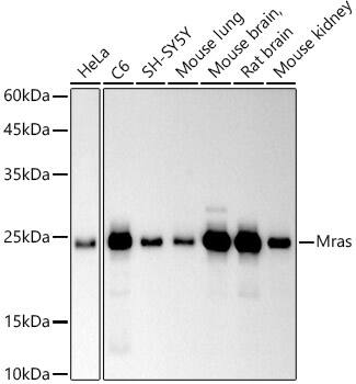 Western Blot: M-Ras/R-Ras3 Antibody (3F6Q10) [NBP3-33251] - Western blot analysis of various lysates using M-Ras/R-Ras3 Rabbit mAb at 1:500 dilution.Secondary antibody: HRP-conjugated Goat anti-Rabbit IgG (H+L) at 1:10000 dilution.Lysates/proteins: 25ug per lane.Blocking buffer: 3% nonfat dry milk in TBST.Detection: ECL Basic Kit.Exposure time: 90s.