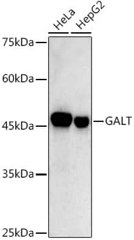 Western Blot: GALT Antibody (2R0A8) [NBP3-33255] - Western blot analysis of various lysates using GALT Rabbit mAb at 1:500 dilution.Secondary antibody: HRP-conjugated Goat anti-Rabbit IgG (H+L) at 1:10000 dilution.Lysates/proteins: 25ug per lane.Blocking buffer: 3% nonfat dry milk in TBST.Detection: ECL Basic Kit.Exposure time: 90s.