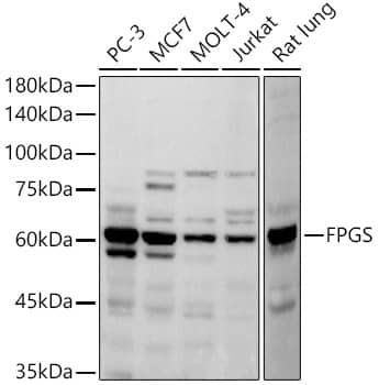 Western Blot FPGS Antibody (7E2H1)