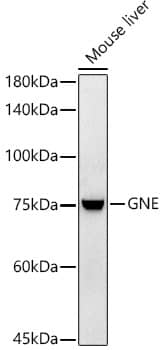 Western Blot: N-Acetylmannosamine Kinase/GNE Antibody (5T9K10) [NBP3-33260] - Western blot analysis of lysates from Mouse liver, using N-Acetylmannosamine Kinase/GNE Rabbit mAb at 1:1000 dilution.Secondary antibody: HRP-conjugated Goat anti-Rabbit IgG (H+L) at 1:10000 dilution.Lysates/proteins: 25ug per lane.Blocking buffer: 3% nonfat dry milk in TBST.Detection: ECL Enhanced Kit.Exposure time: 60s.